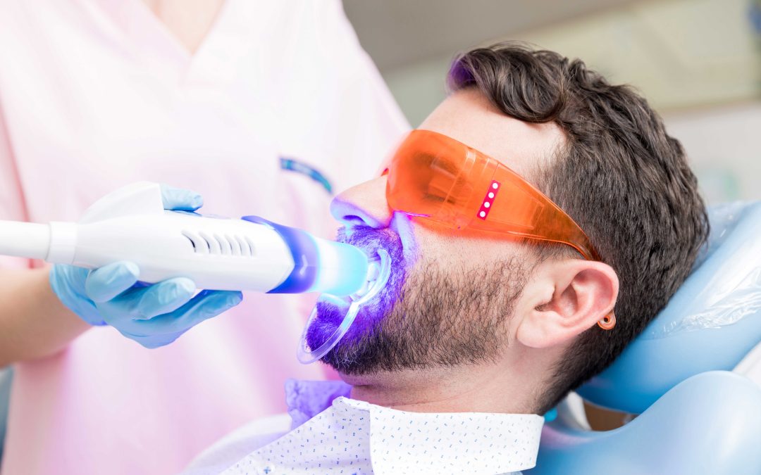 Verdades y mitos sobre el blanqueamiento dental